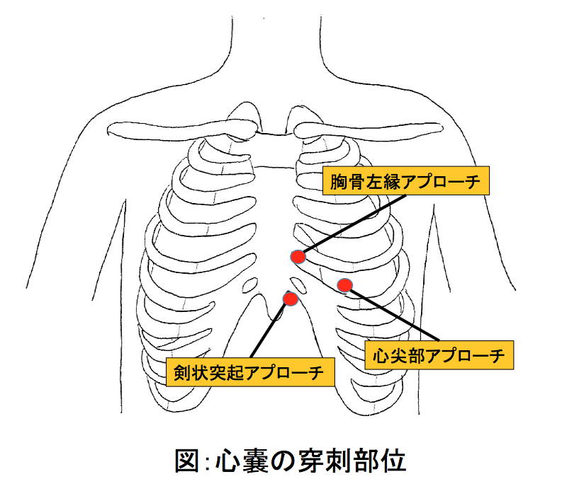 緊急心嚢穿刺 救命救急センター 東京医科大学八王子医療センター