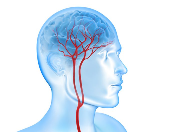 脳血管イメージ